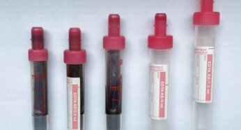 Is it possible to verify the correctness of the sample container used?