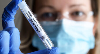 Priority driven sample preparation for PCR testing